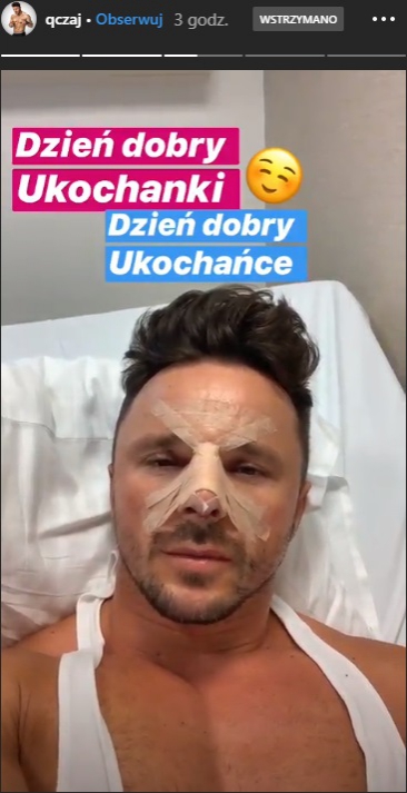 Qczaj zoperował sobie nos. Pokazał, jak wygląda po operacji