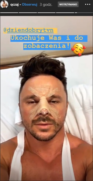 Qczaj zoperował sobie nos. Pokazał, jak wygląda po operacji