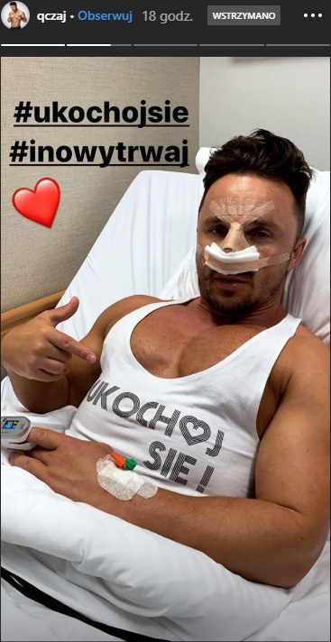 Qczaj zoperował sobie nos. Pokazał, jak wygląda po operacji