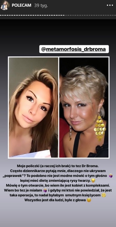 Operacje plastyczne Blanki Lipińskiej. Pisarka poprawiała urodę. Tak wyglądała kiedyś