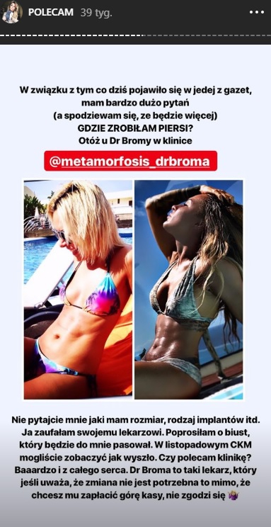 Operacje plastyczne Blanki Lipińskiej. Pisarka poprawiała urodę. Tak wyglądała kiedyś