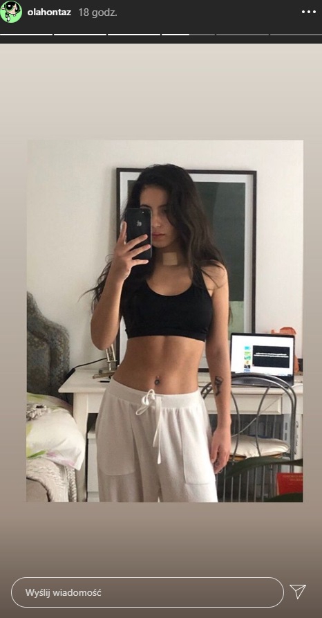 Córka Kasi Kowalskiej po wyjściu ze szpitala. Na zdjęciu uwagę przykuwa ślad po chorobie