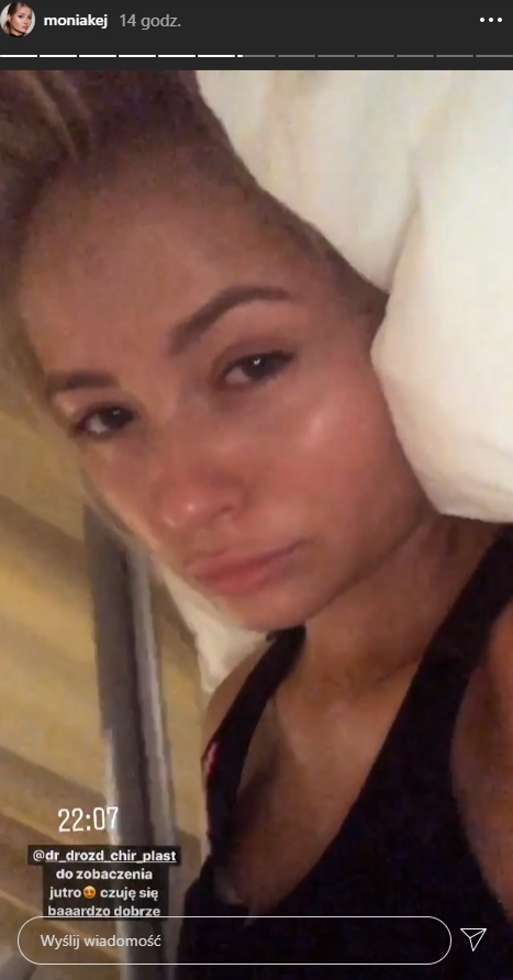 Monika z "Love Island" powiększyła piersi. Pokazała pierwsze efekty na Instagramie