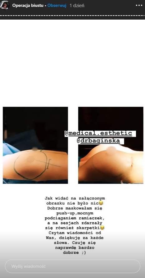 Marietta z "Love Island" chwali się nowym biustem. Pokazała zdjęcie po operacji [18+]