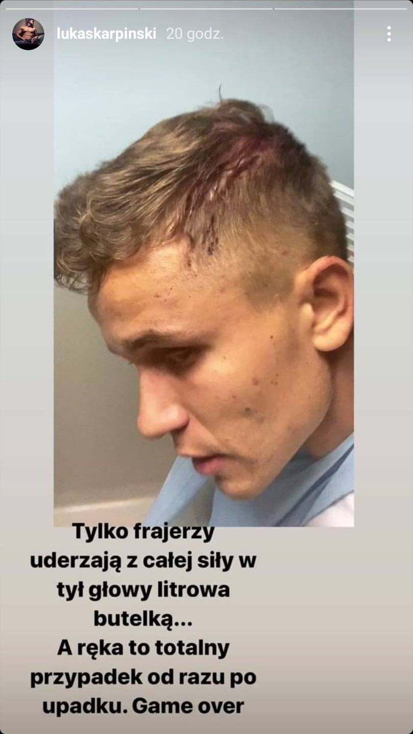 "Hotel Paradise 2". Łukasz Karpiński ofiarą brutalnego ataku! Uczestnik został pobity [FOTO]
