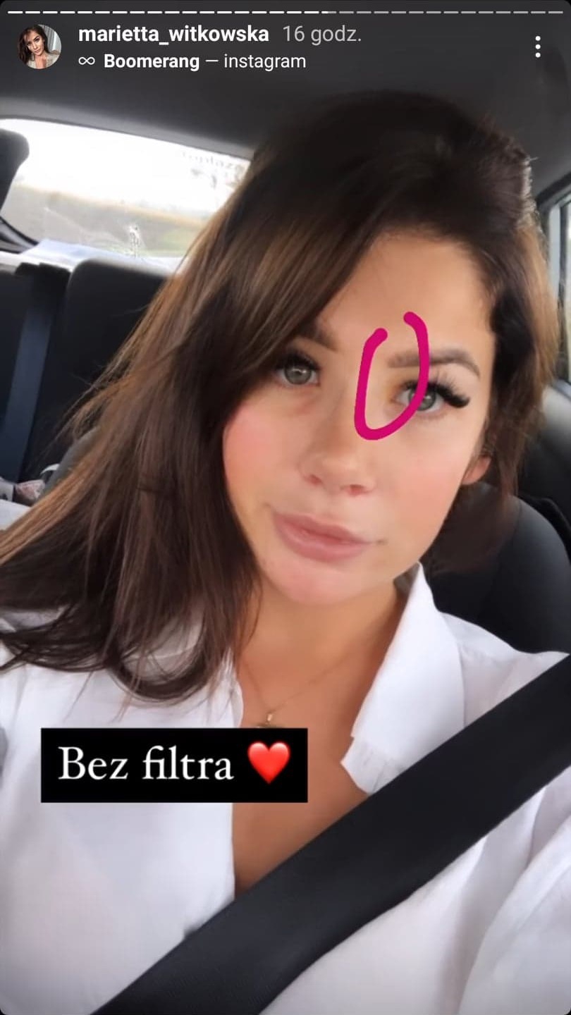 Marietta z "Hotelu Paradise" przeszła operację plastyczną. Pokazała efekty. Zmiany widoczne gołym okiem 