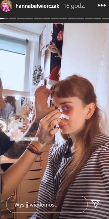 Hania z "Hotelu Paradise" odsłania nos po "operacji". "Mam nadzieję, że mi wybaczycie"