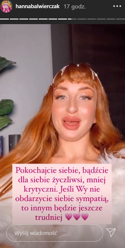 Hania z "Hotelu Paradise" odsłania nos po "operacji". "Mam nadzieję, że mi wybaczycie"