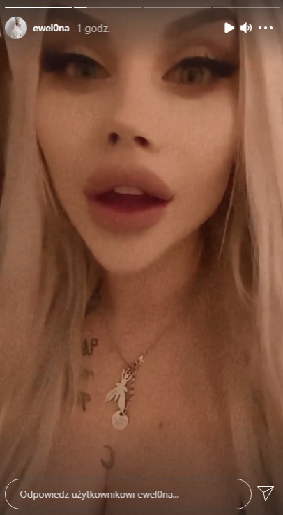 EwelOna z "Warsaw Shore" pokazała twarz po operacjach. Dlaczego zniknęła z sieci? "To było piekło"