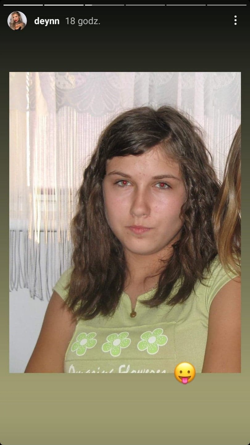 Deynn pokazała, jak wyglądała jako nastolatka. Przeszła gigantyczną metamorfozę. Komentuje specjalistka medycyny estetycznej