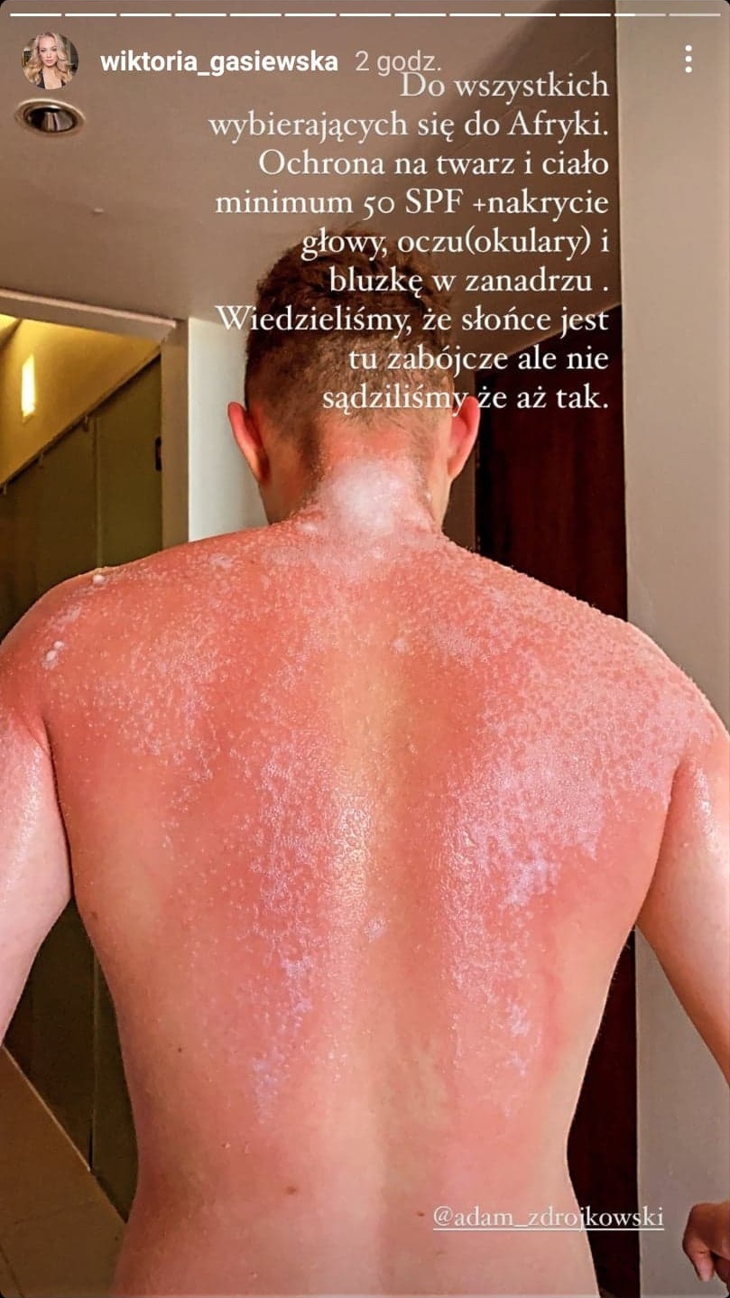 Wiktoria Gąsiewska w bikini. Aktorka odsłania ciało w "zabójczym" słońcu Afryki