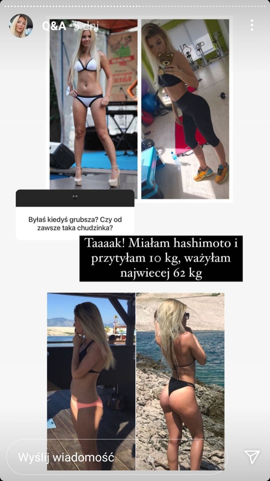 Angela z "Love Island" kiedyś ważyła więcej. Tak wtedy wyglądała [ZDJĘCIA]