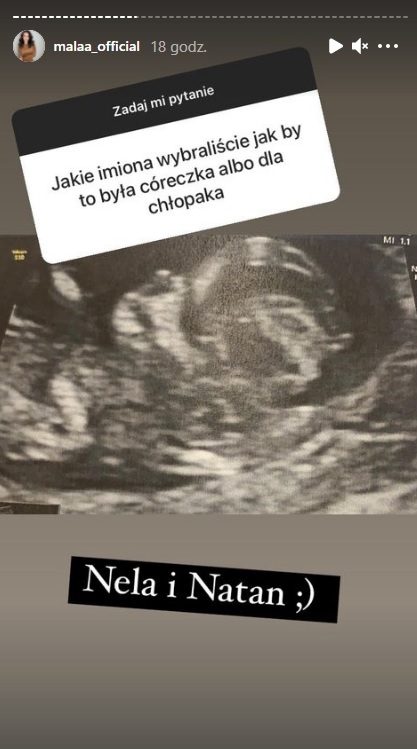 Mała Ania z "Warsaw Shore" w ciąży. Internauci pytają o... jej dalszy udział w programie!