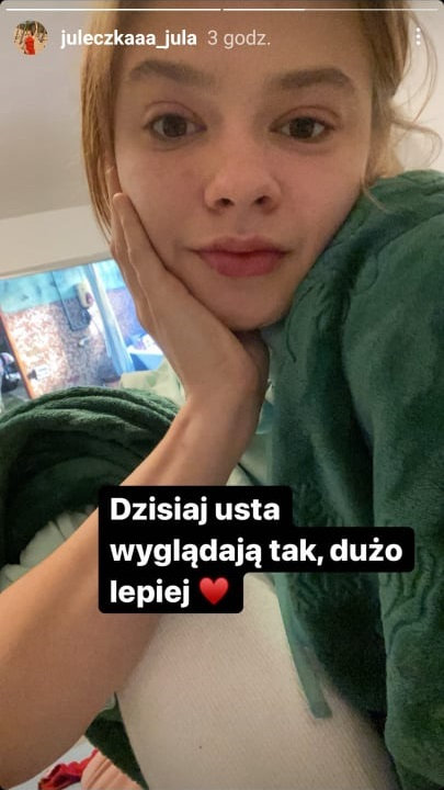 Julia Wróblewska poprawiła urodę. Pokazała, jak jej twarz zmieniła się po zabiegu [FOTO]