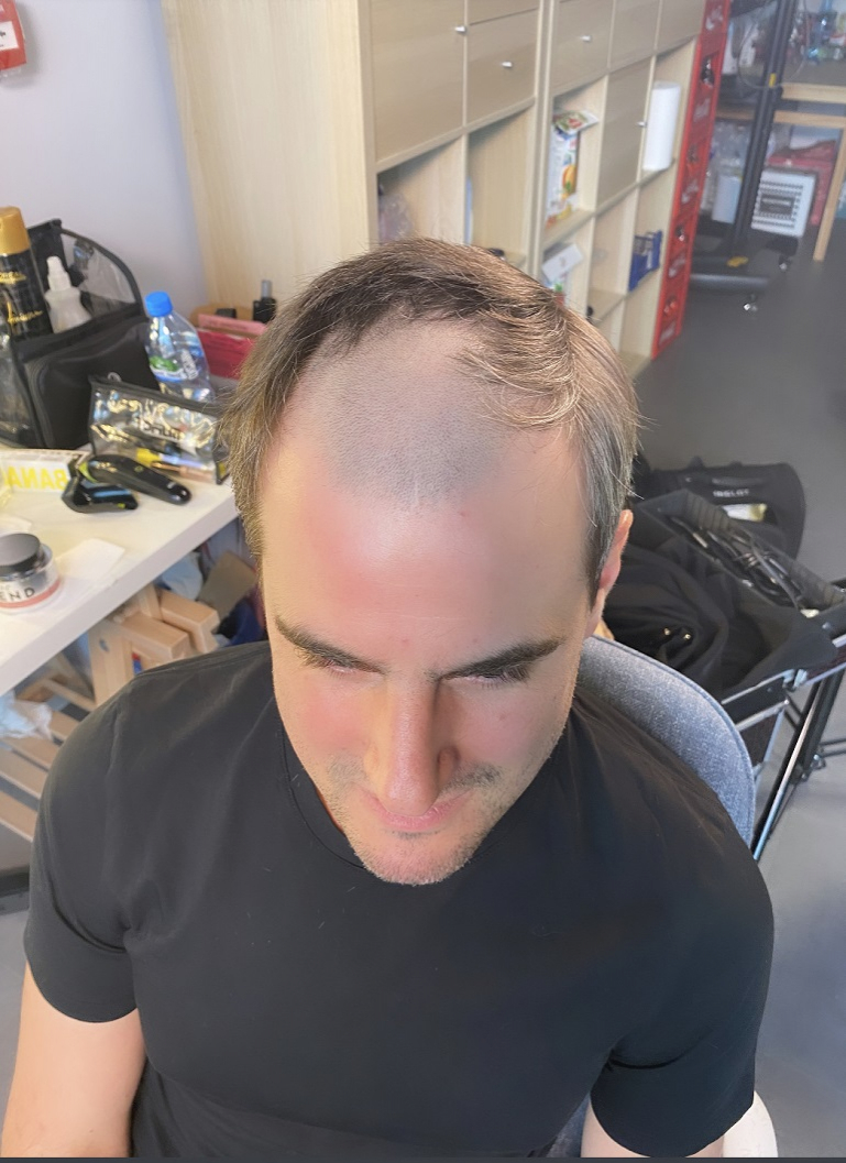 Tupecik Antoniego Pawlickiego. Zobacz, jak poradził sobie z łysiną na planie serialu! [FOTO]