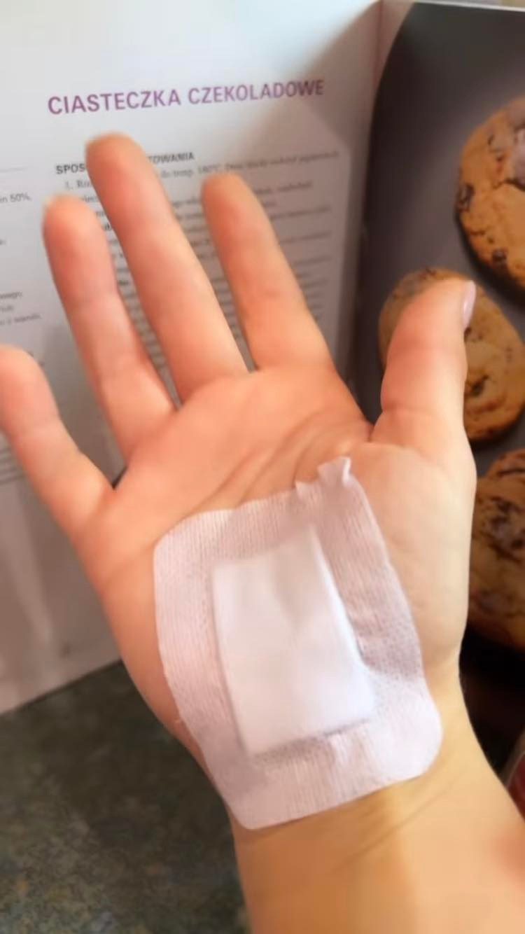 Katarzyna Cichopek opowiedziała o swoim stanie zdrowia. Aktorka przeszła operację