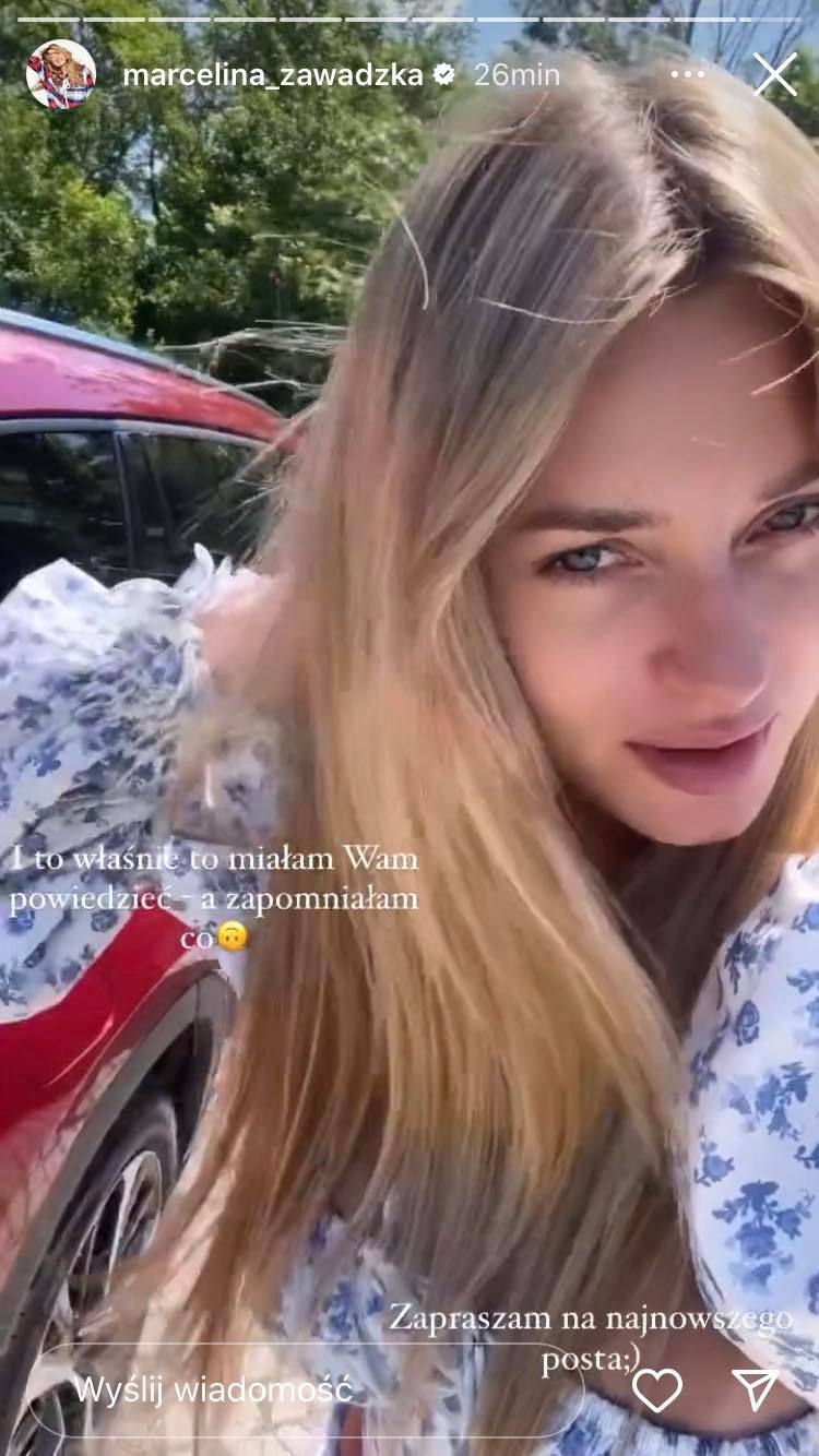 Marcelina Zawadzka w naturalnym wydaniu. Modelka pozuje bez makijażu! [ZDJĘCIA]