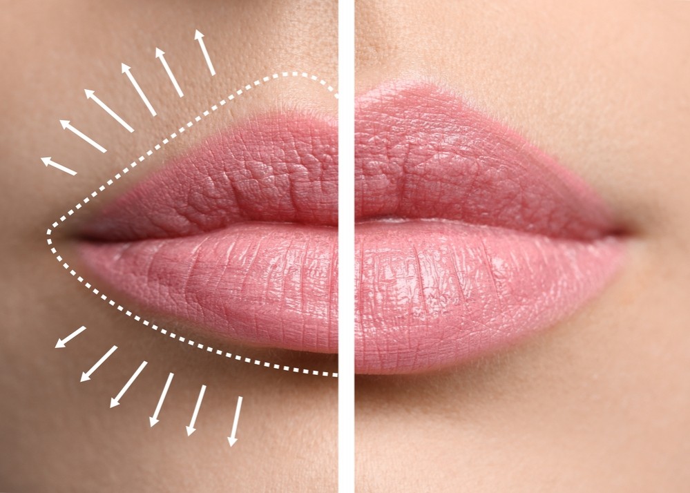 Jak optycznie powiększyć usta?