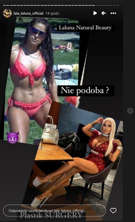 Jak wyglądała Laluna, zanim zrobiła operacje plastyczne? Oto zdjęcia sprzed 17 lat! [FOTO]