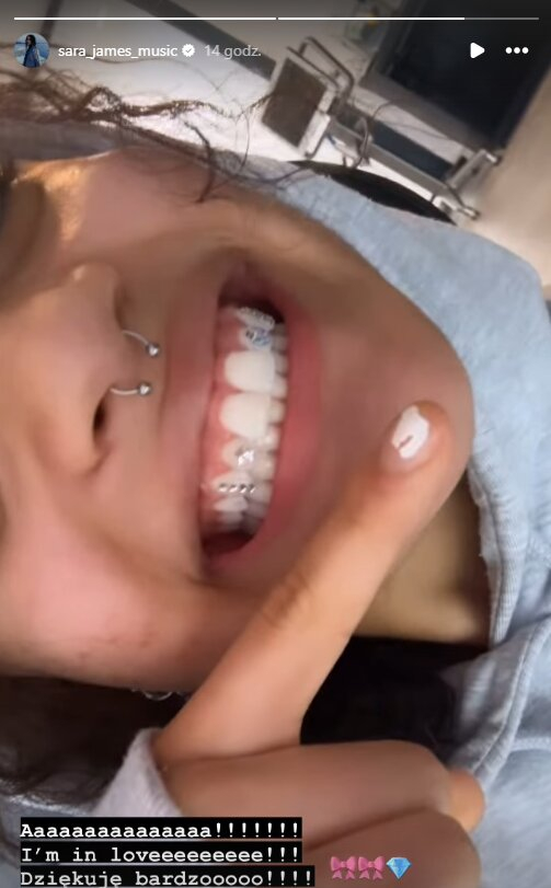 Sara James zaszalała! Zmieniła wygląd swoich zębów. Tak się teraz prezentują [FOTO]