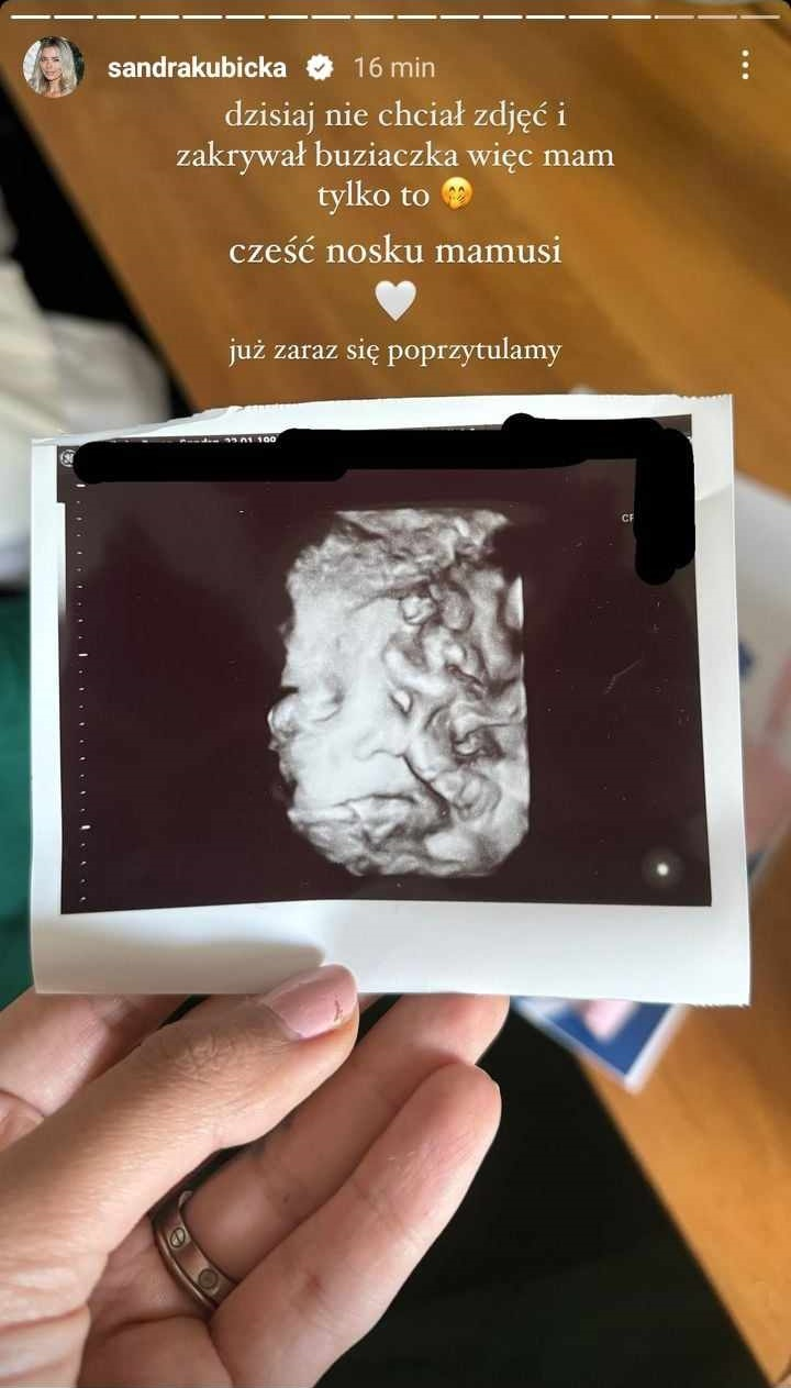 Sandra Milwiw-Baron opublikowała zdjęcie synka. "Zaraz się poprzytulamy" [FOTO]