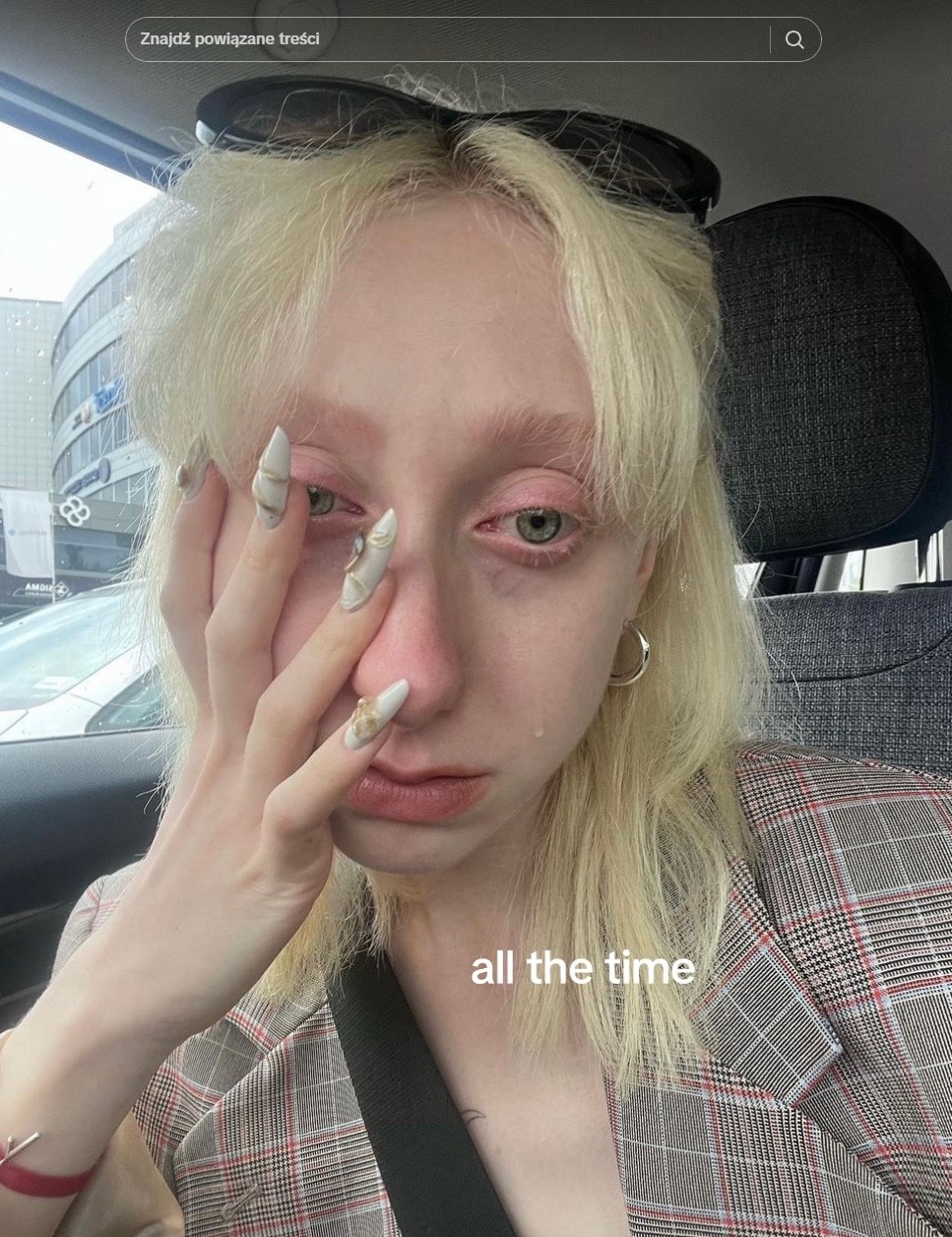 Po Eurowizji musiała długo płakać. Luna pokazała szokujące zdjęcia [FOTO]