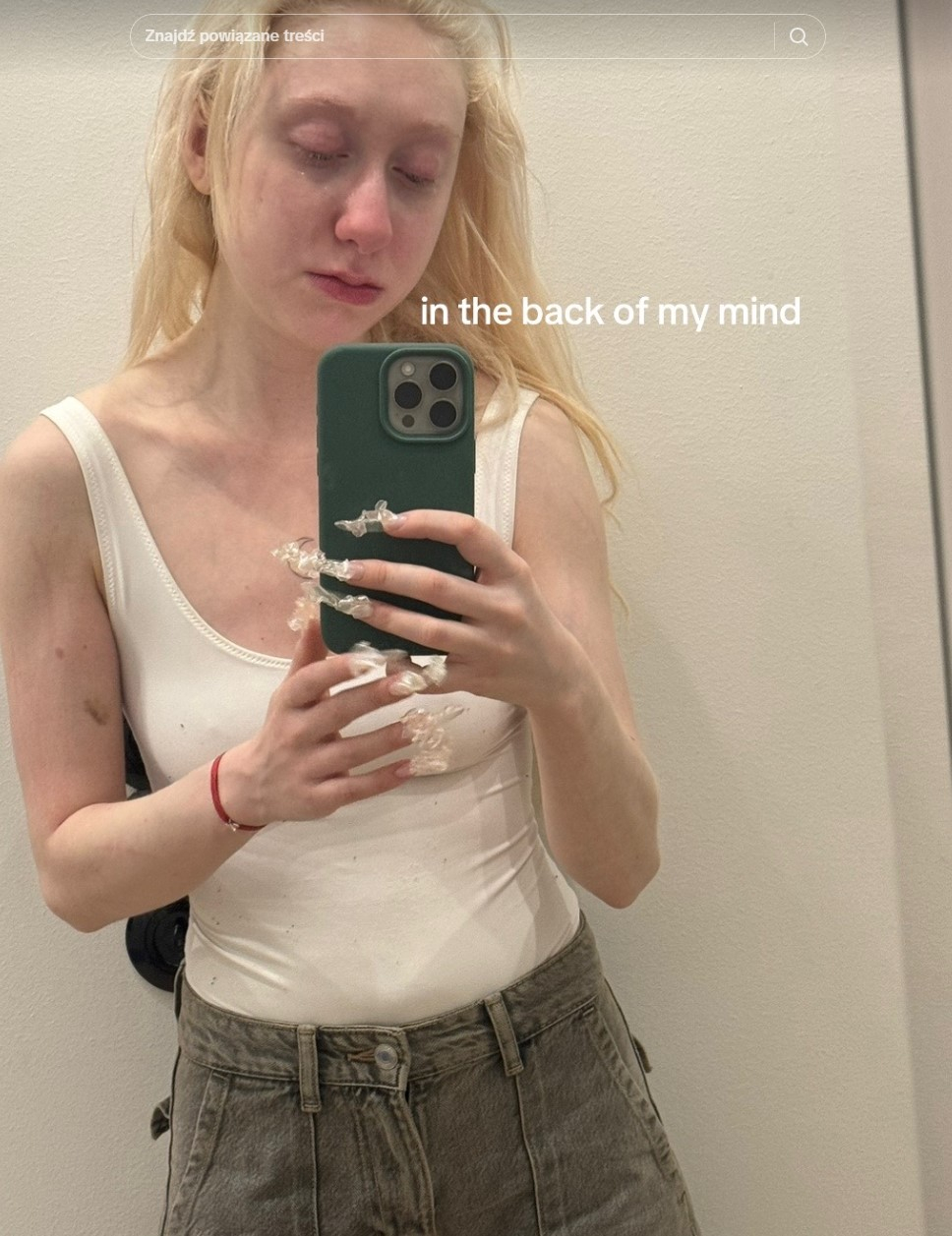 Po Eurowizji musiała długo płakać. Luna pokazała szokujące zdjęcia [FOTO]